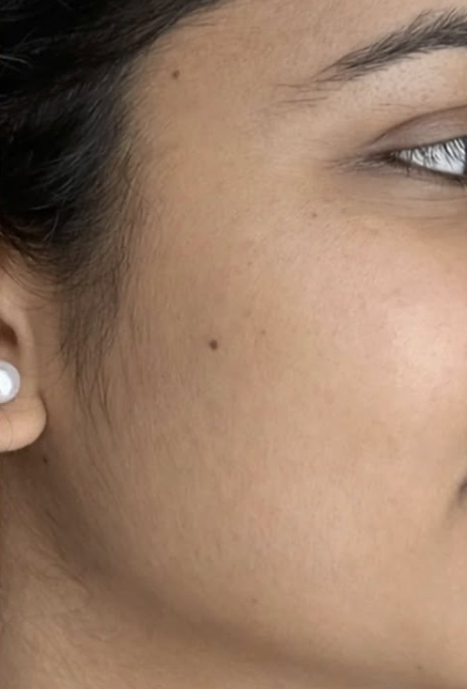 After: skin looks smoother with a more even tone